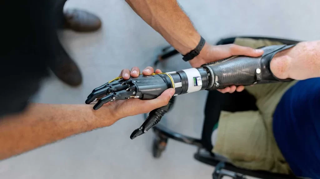 Upper Limb Prosthetics